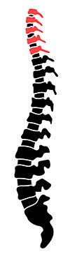cervical spinal cord injury
