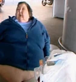 obese woman wrongful death
