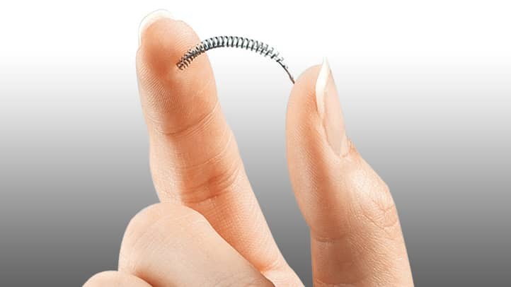FDA Reports 30 Essure Deaths and 10,000 Injuries