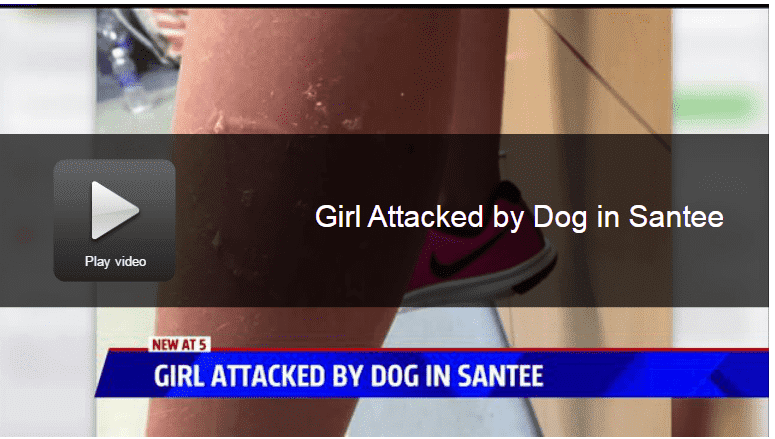 San Diego Mom on the Hunt for Owner of Dog that Attacked Her Child