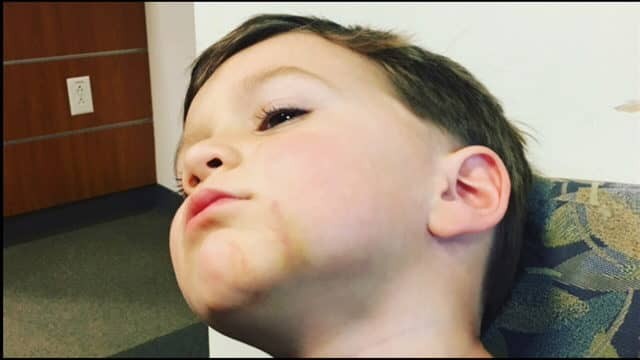 Child Bitten by Possible Service Dog at Grocery Store