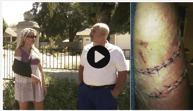 Woman Severely Injured in Dog Attack Still Seeks Owner